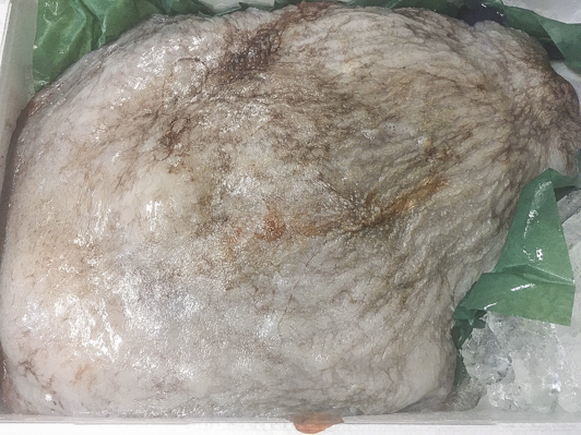 生水タコ頭 八面六臂